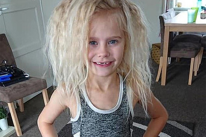 Ребенок отказался от расчески из-за редчайшей мутации волос